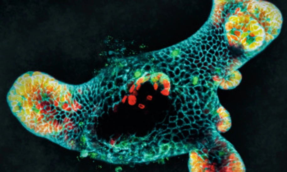 IDR_Cover_Nature Cell Biology