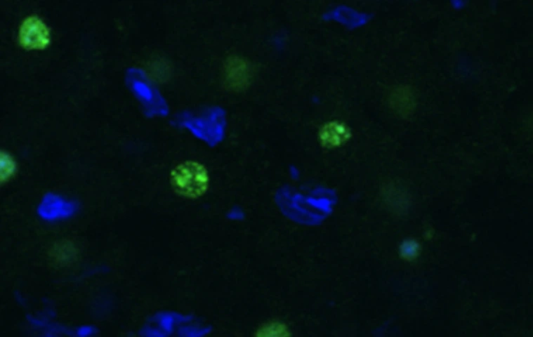 Cortex MidHindBrain