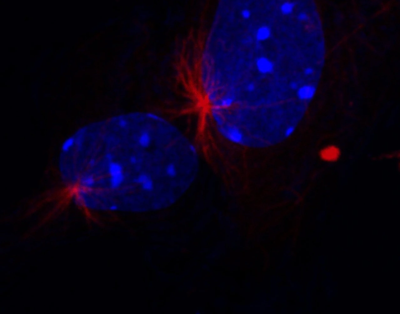 E14cortexday1_Tubaplhaaster