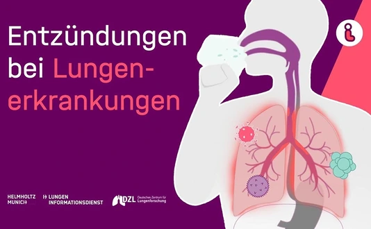 Video-Vorschaubild: Entzündungen bei Lungenerkrankungen