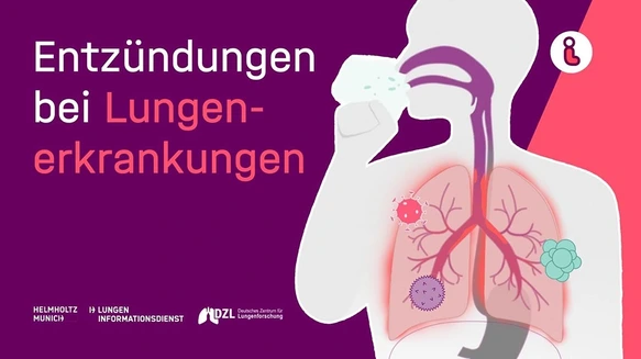 Video-Vorschaubild: Entzündungen bei Lungenerkrankungen