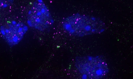 Image of specific RNAs (magenta) at the centrosome (green) in mouse cortex cells. The cell nucleus is labeled in blue.
