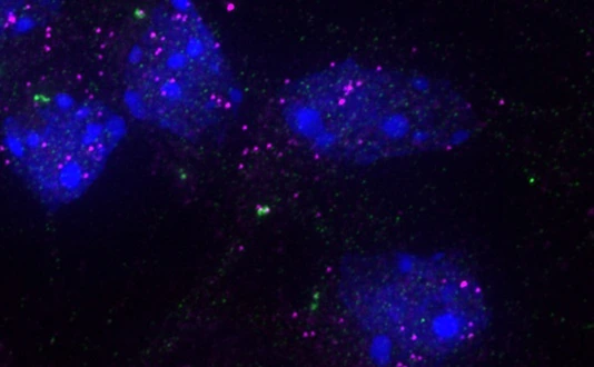 Image of specific RNAs (magenta) at the centrosome (green) in mouse cortex cells. The cell nucleus is labeled in blue.