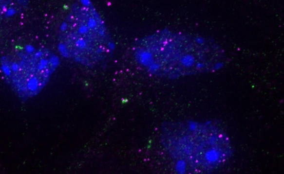 Image of specific RNAs (magenta) at the centrosome (green) in mouse cortex cells. The cell nucleus is labeled in blue.