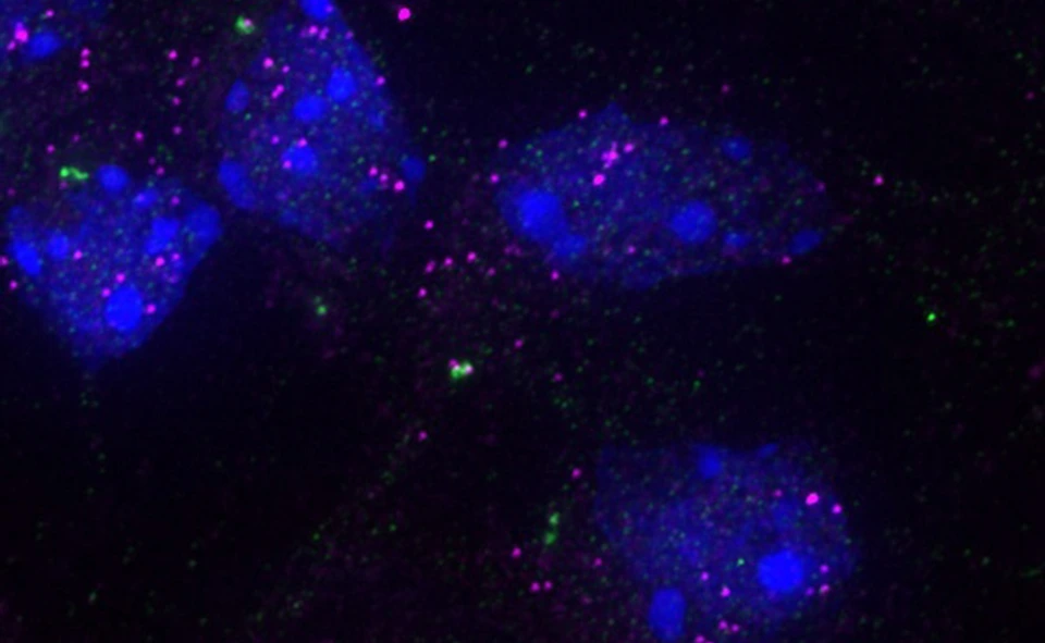 Image of specific RNAs (magenta) at the centrosome (green) in mouse cortex cells. The cell nucleus is labeled in blue.
