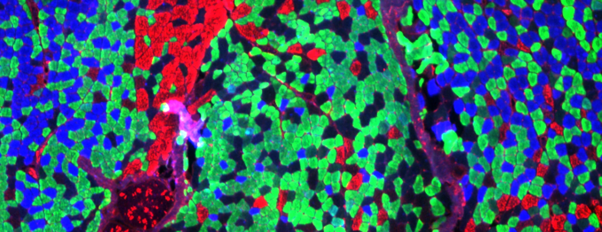 Muscle Fibre Staining