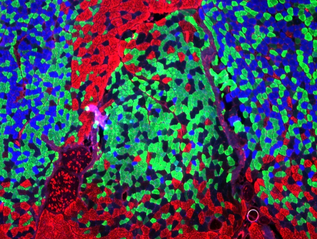Muscle Fibre Staining