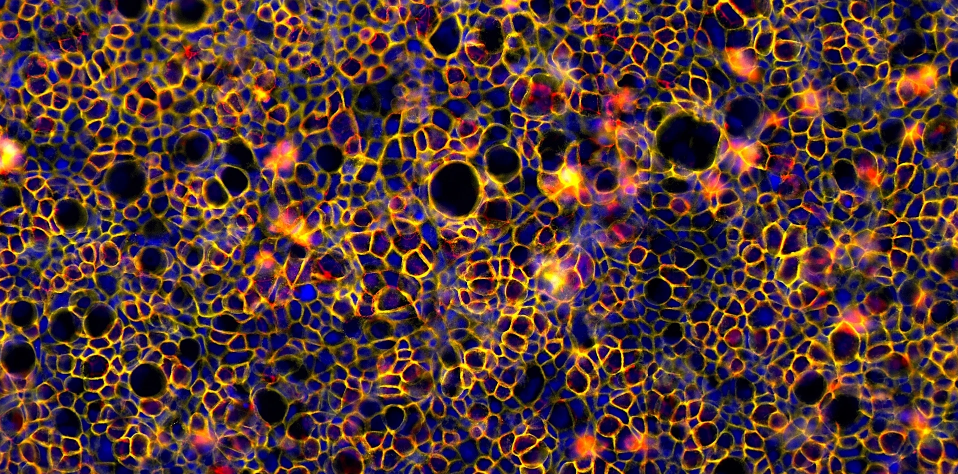 Rodriguez-Calvo_Caco-2 cells