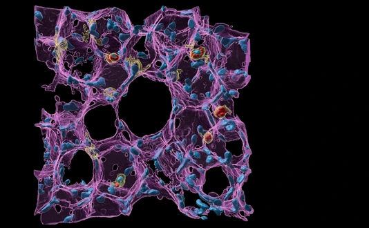 Lung health and immunity by Lin Yang HI_Website-News-images_BSIC2023_Winner_Main-Image