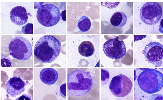 bone marrow cells