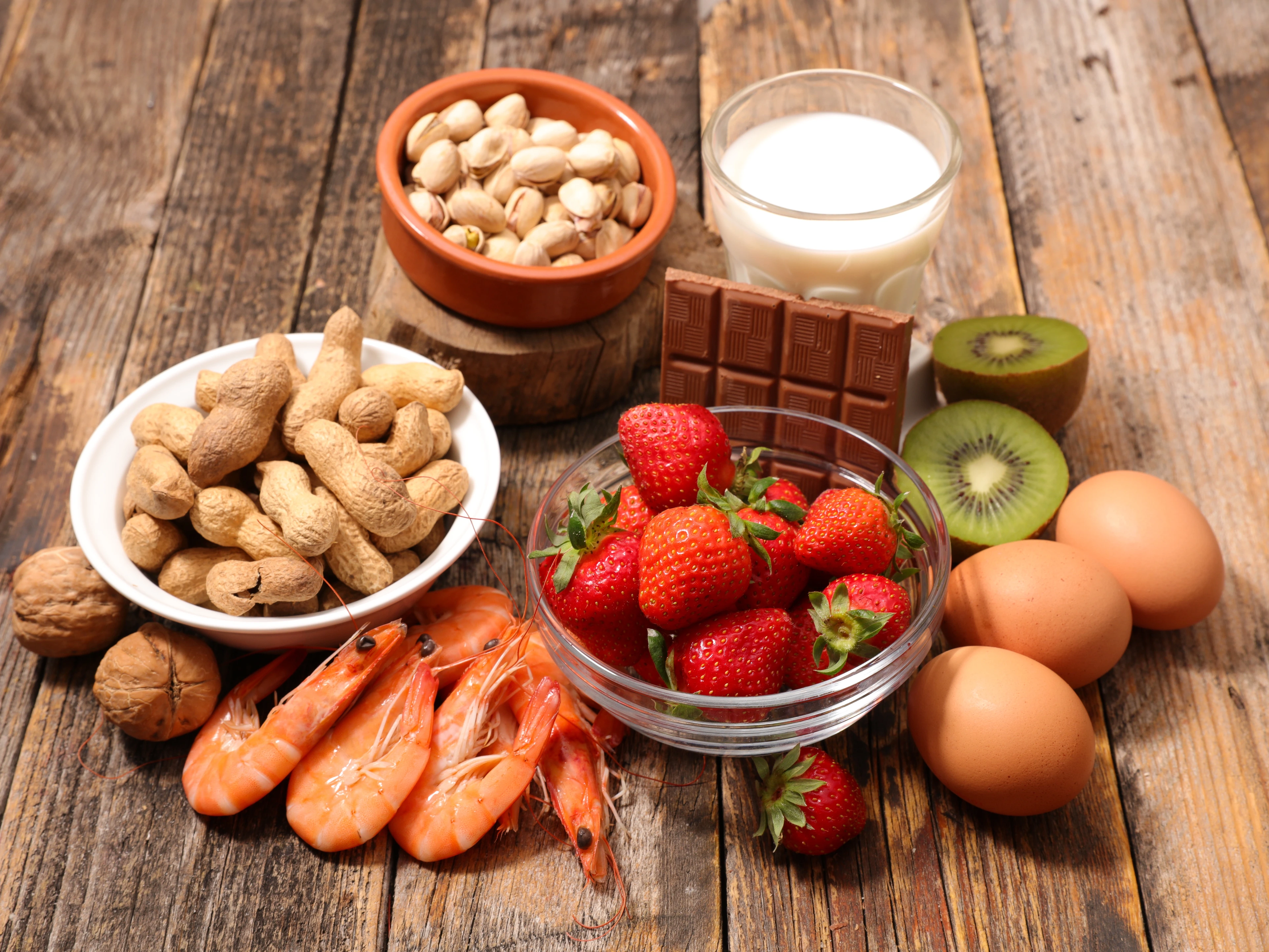 assorted food ingredient
AdobeStock_186823335