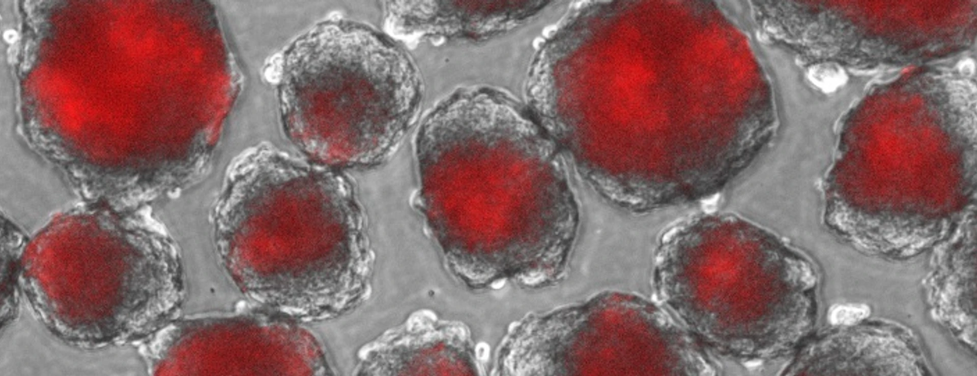 IDR_stem cell group_Ingo Burtscher