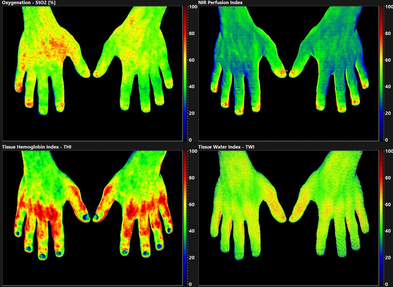 Beispiel einer TIVITA-Messung