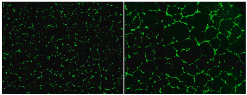 Matrigel-based tube formation of HUVECs with ASPC-conditioned media