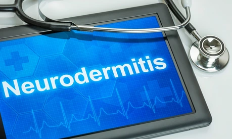 Tablet mit Diagnose Neurodermitis